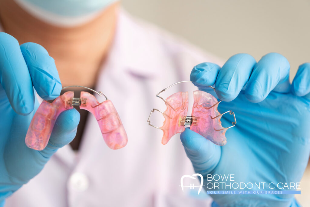 Introduction to Popular Orthodontic Terms